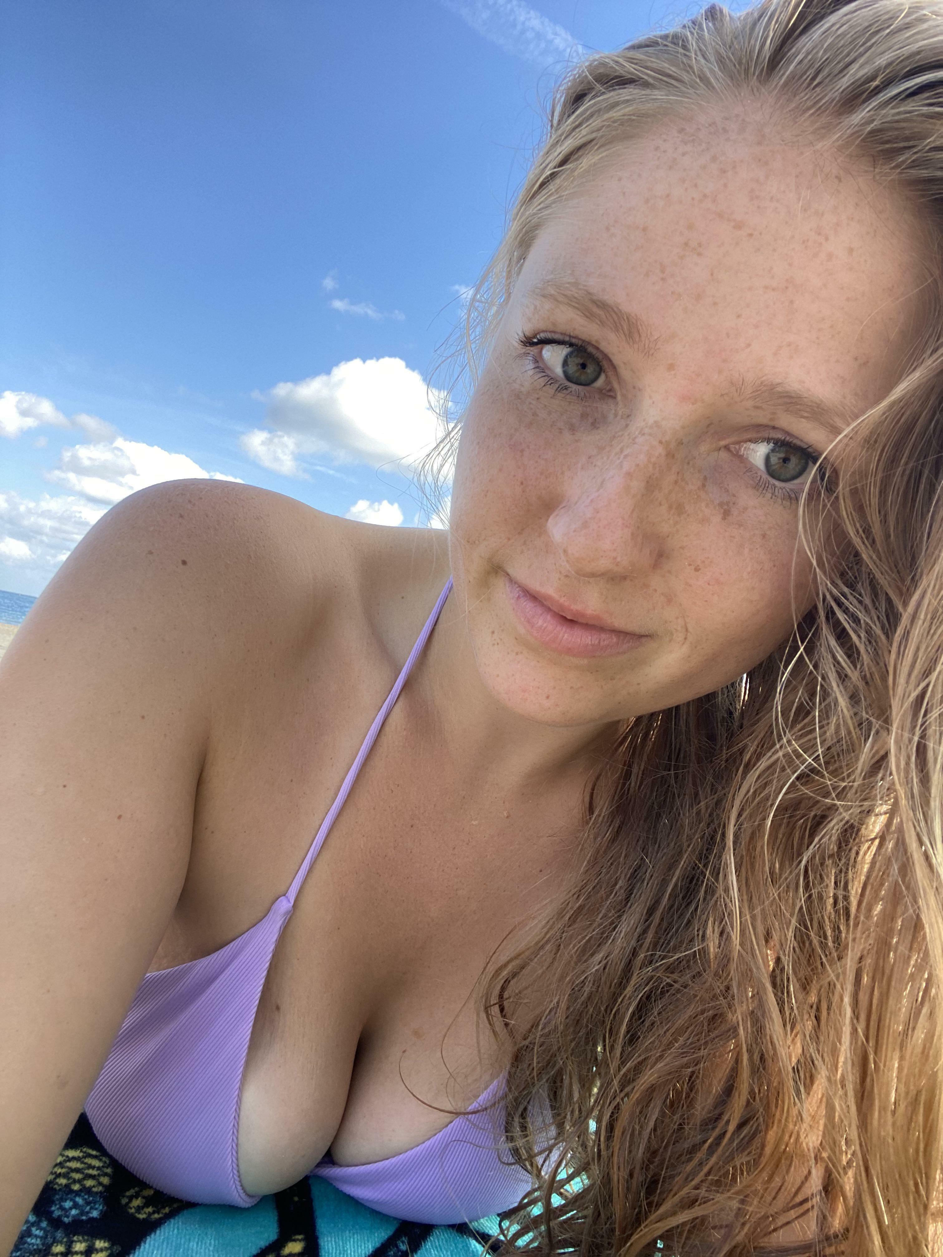 Collecting freckles in Mexico ?