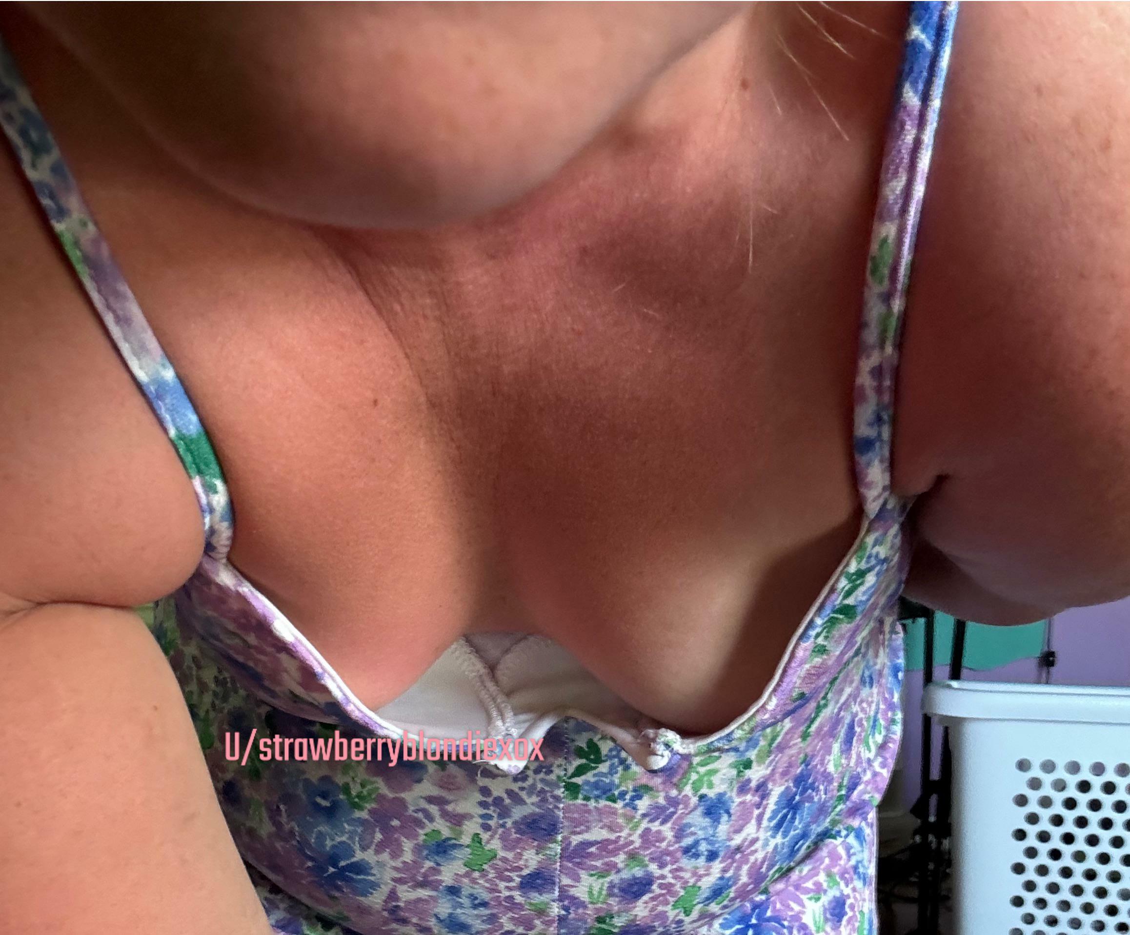 Got a little burnt this weekend.