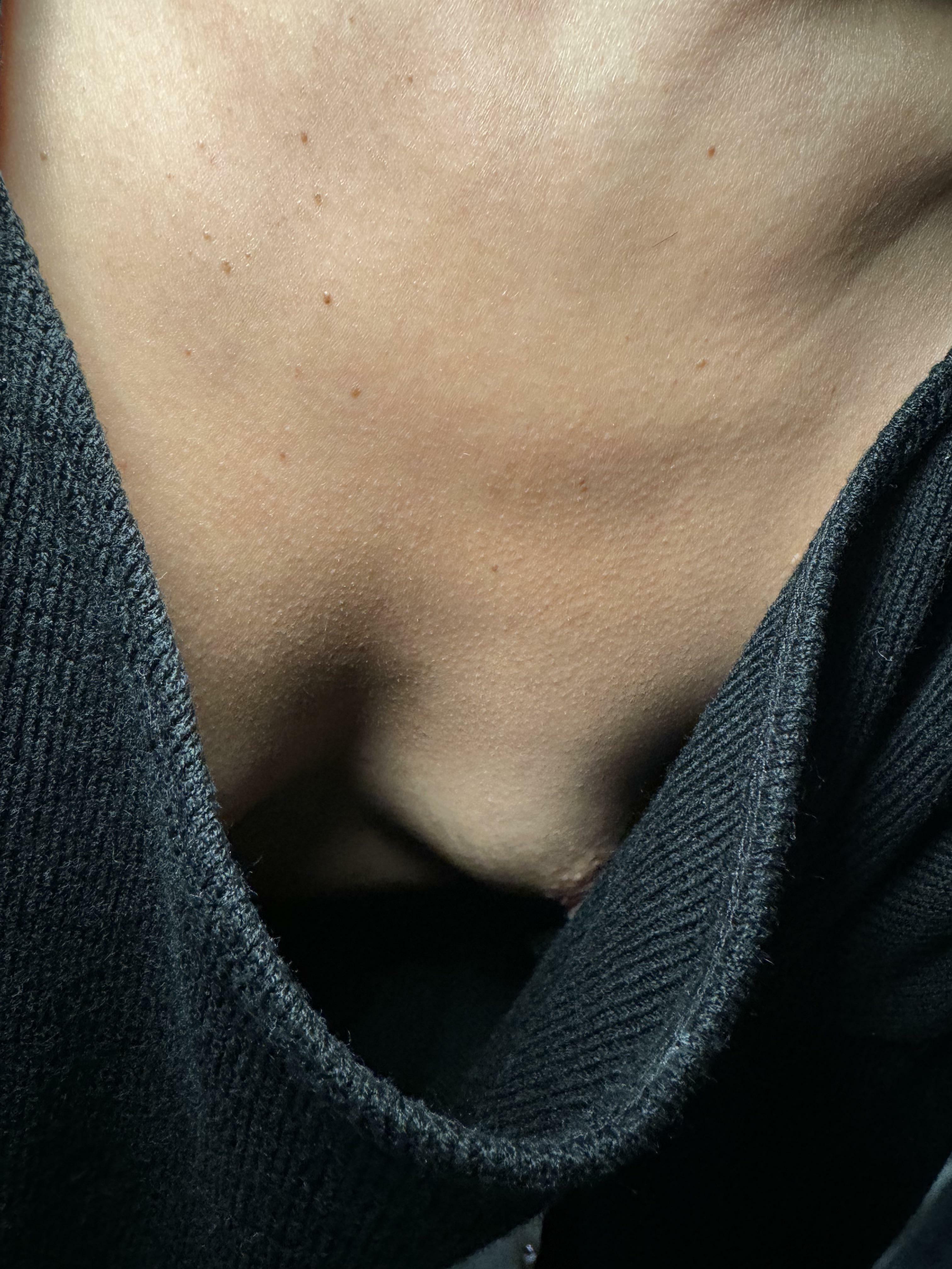 I lost my bra again