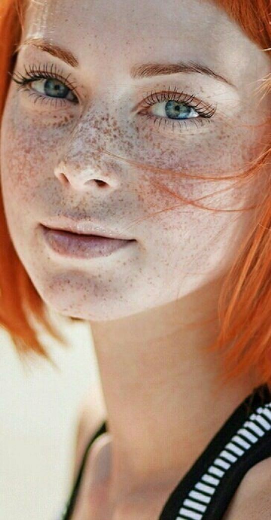 Freckle overload.