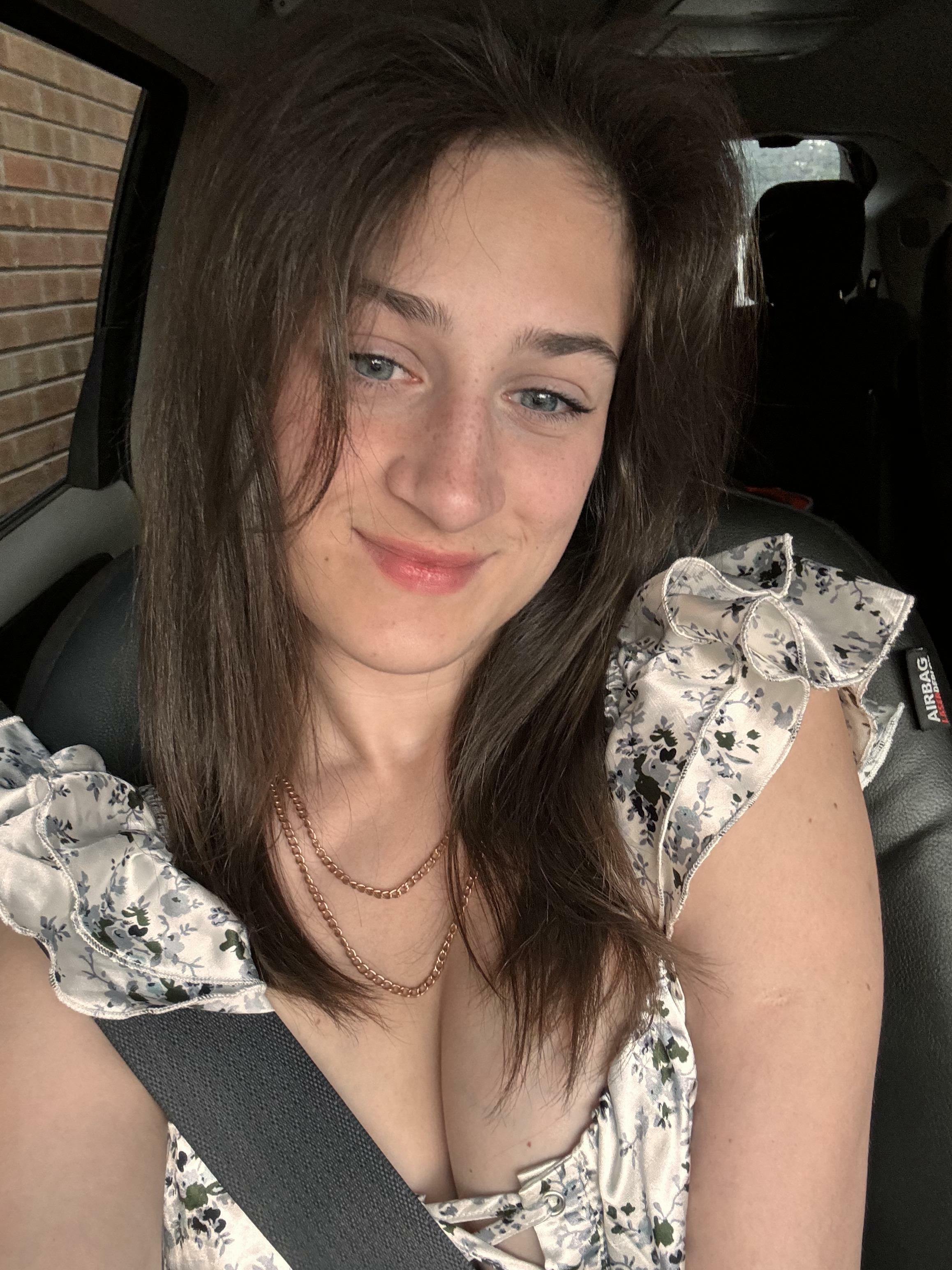 Do I have to many freckles