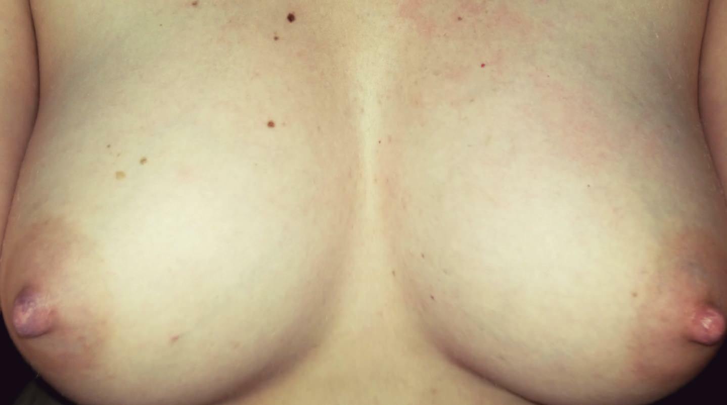 (f) Who wants to abuse my tits?