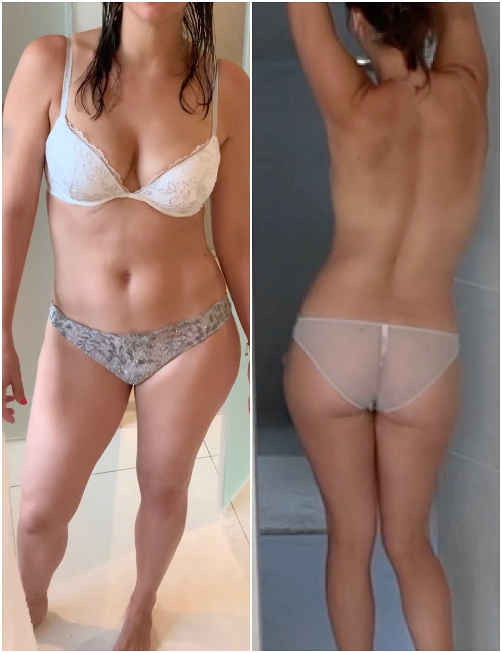 Front and back x