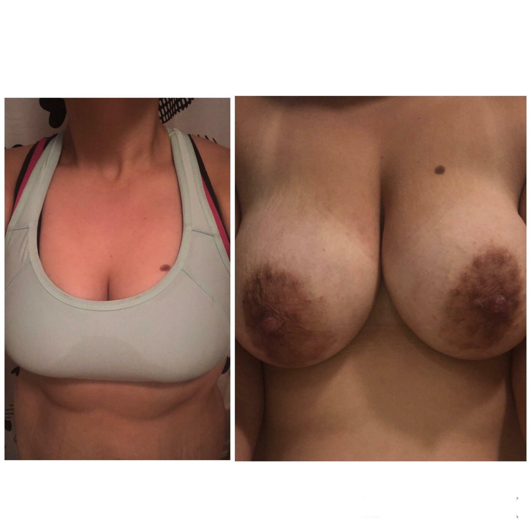 My first on/off. Post workout this morning [F 30]