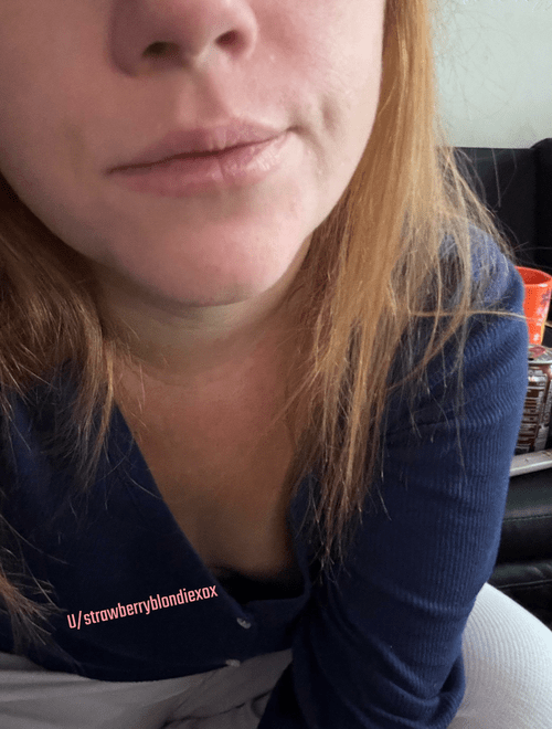 Cleavage