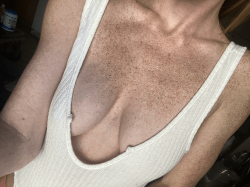 Hope you like freckles too