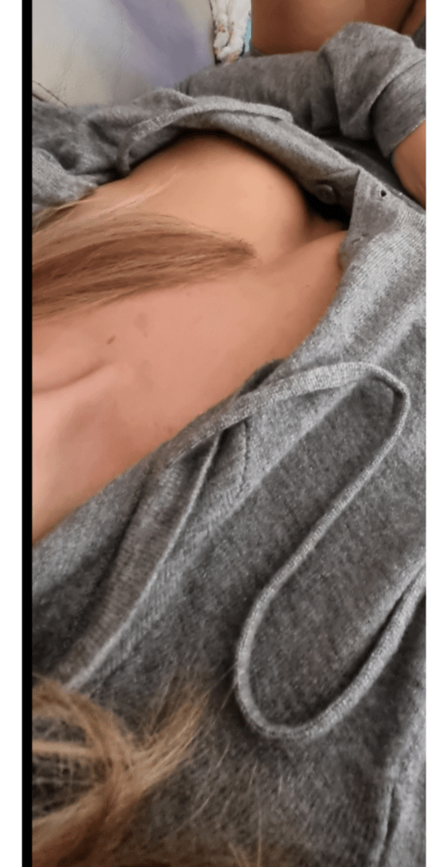 Cleavage