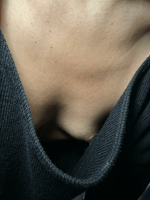 I lost my bra again