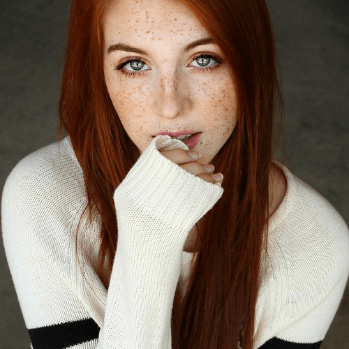 Freckles