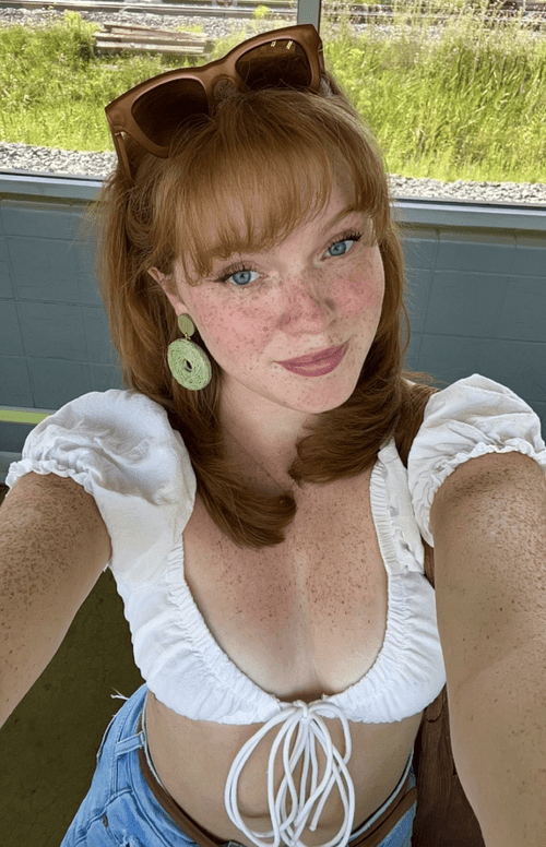 summer freckles