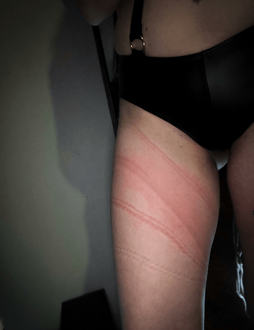 The rope, the bites, the bondage 28