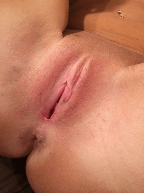 A close up look at my holes. Thank God for C-sections.