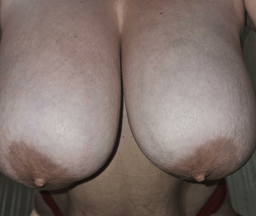 This could be your view if i'm on top